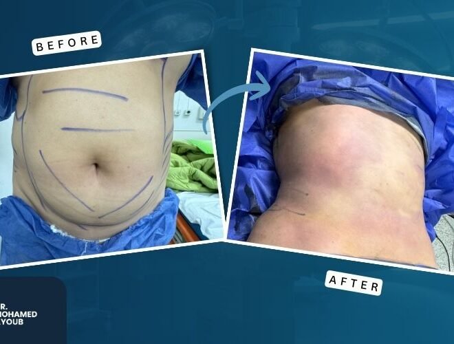 Before & After (2)