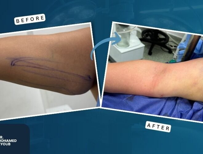 Before & After (3)