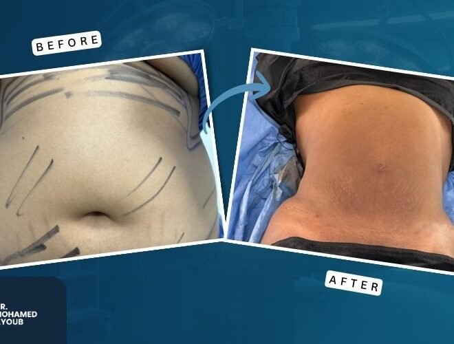 Before & After (4)