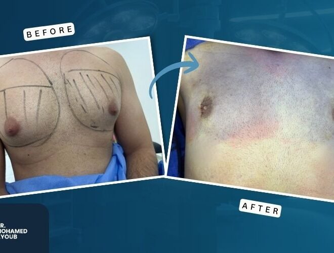 Before & After